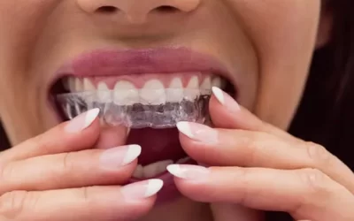 Invisalign Minneapolis: Clear Aligner Therapy for Discreet Orthodontic Correction